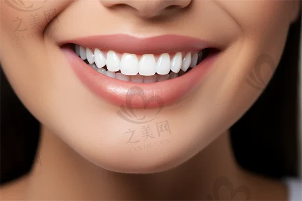 杭州哪个医院看牙科比较好 附带杭州整牙项目价格表