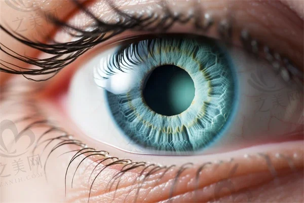 0视力是否表示患有近视眼？专家权威解读