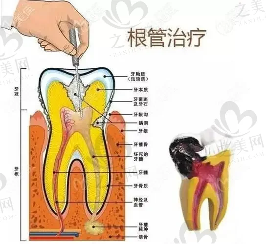 武汉口碑好的种植牙医院合集,排名前十公布附2023价格表