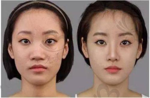 悦慕（沈阳）医疗美容诊所真人口碑评价