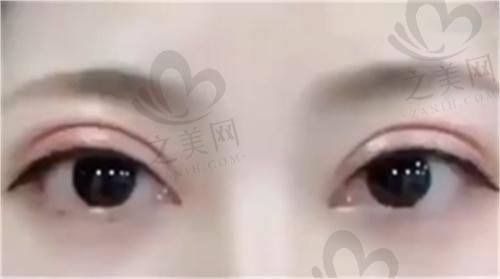 北京地坛医院医学美容科是正规医院吗？