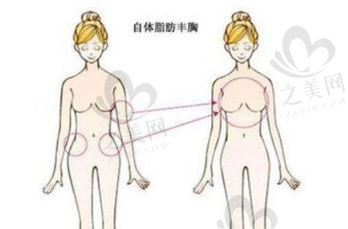 孝感市中 心医院整形科简介