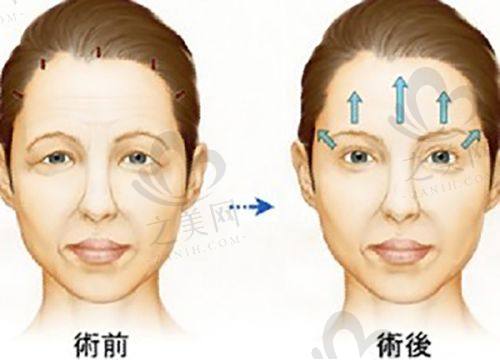 孝感市中 心医院整形科是正规医院吗？