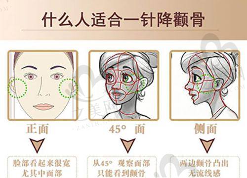 北京市海淀医院整形美容科特色项目及技术优势