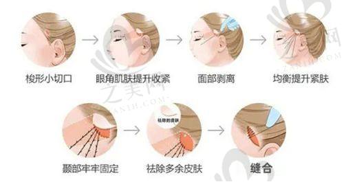 收费价格参考