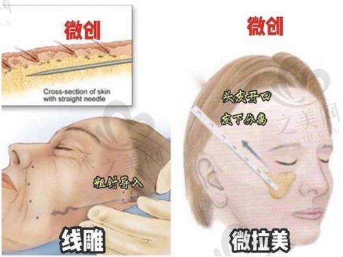 北京地坛医院医学美容科特色项目及技术优势