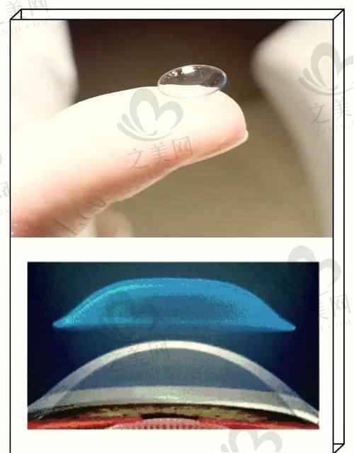2025上海眼科医院排名前三等甲