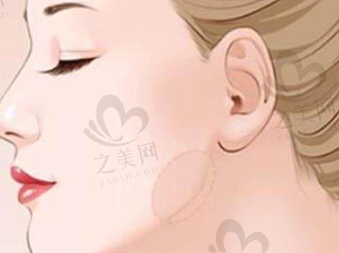 重庆松山医院靠谱不,面部轮廓整形靠谱且技术好,排名前三的整形医院值得去试试