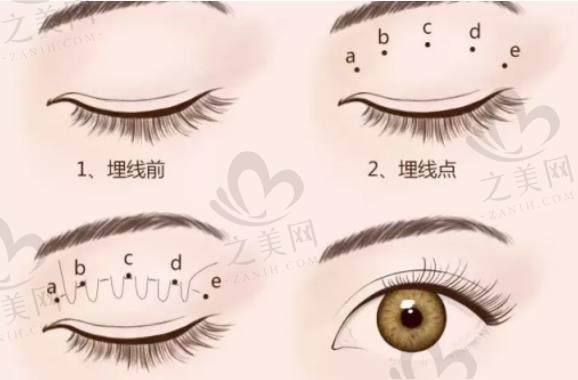 成都双眼皮修复厉害的十大专家,排行榜单会变但医生技术实力始终在线!