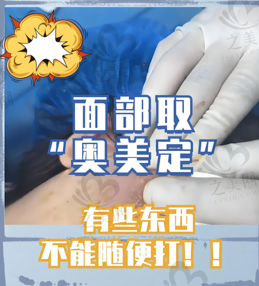 奥美定真会游走到全身!我体内奥美定游离到腰和肚子,找黄广香成功取出