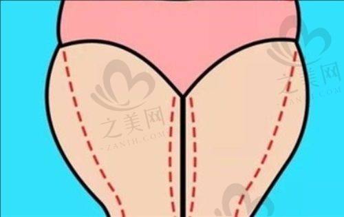袁强博士线下预约地点