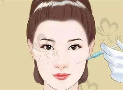 整形皮肤激光体验过程