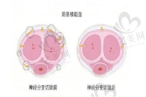 福州名韩医院吸脂价格多少
