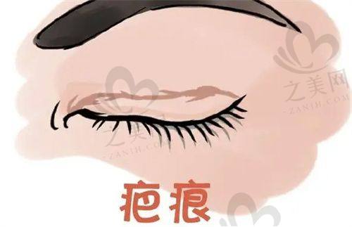 广州丽合肖强做鼻子顾客多