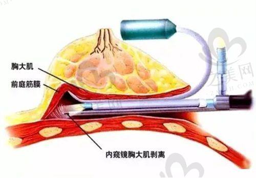 王晓琳医生注射微整形技术