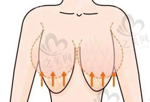上海10家医院紧缩针攻略:全方面了解与选择