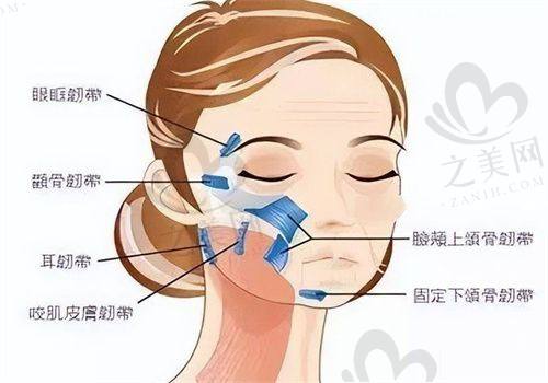 成都李建钢无痕筋膜提升非骗局!术后效果佳,众多真实实例见证靠谱成效