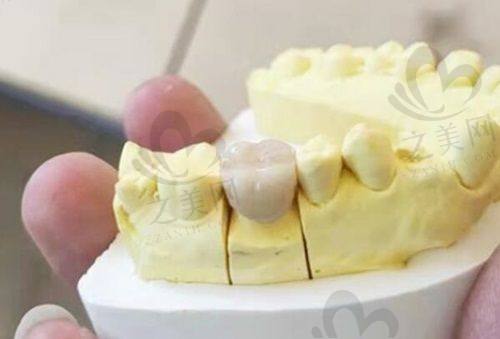 开封豫大口腔:种植正畸实力强