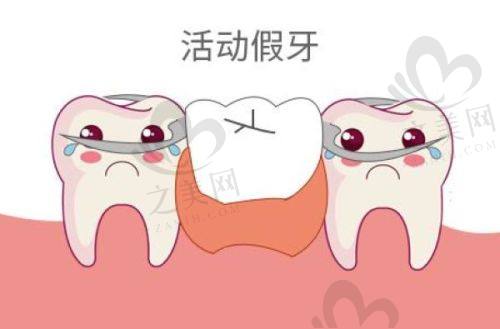 颌垫推簧矫治器与其他矫正器对比