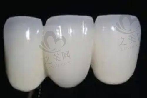 北京劲松口腔五棵松分院种植牙收费价格