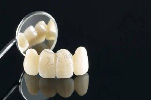 哈尔滨优诺口腔牙齿矫正6千起情况