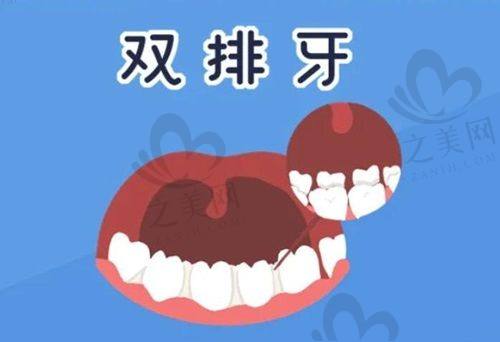 四、价格表透明