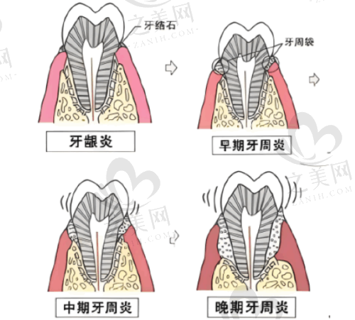 北京劲松口腔医院医疗保险报销情况
