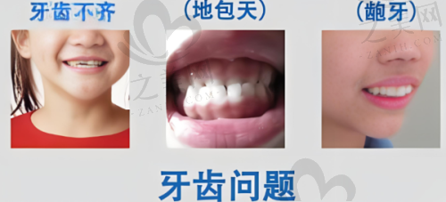 沈阳种植牙集采新政策解读