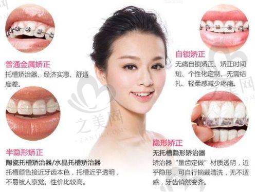 总结