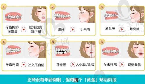 牙齿矫正优势之数字化美学正畸