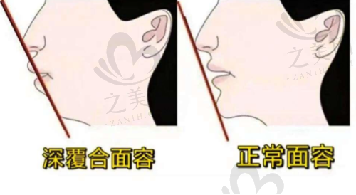 麻城康雅口腔与安雅口腔情况