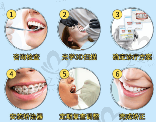 牙齿矫正费用对比