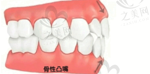 综合牙科项目价格