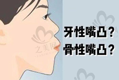 总结