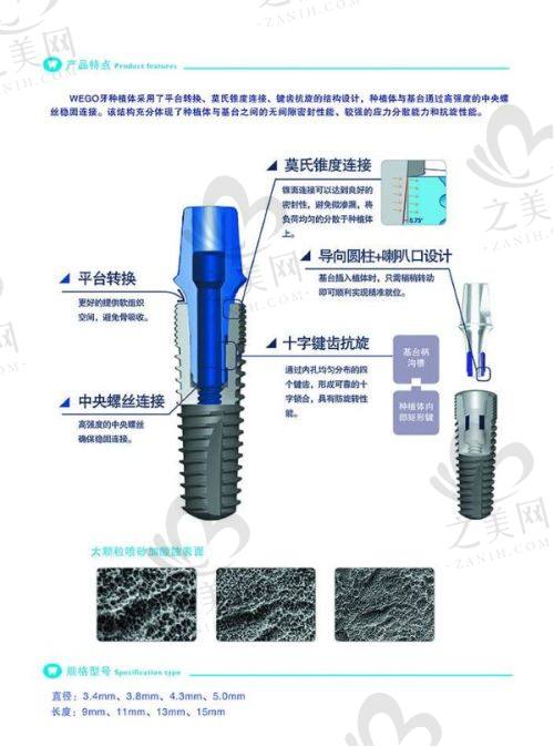 种植牙收费标准