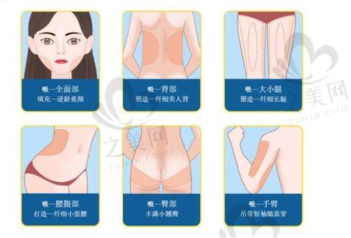 西安王志军拉皮成功实例:真实范例,见证实力