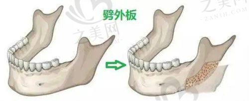 超光子项目询问