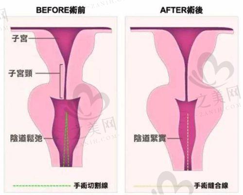 袁强博士擅长领域预约
