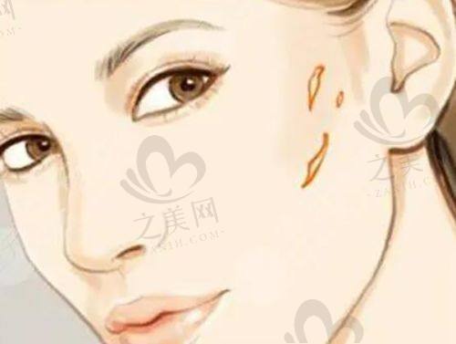 成都新丽美医生推荐