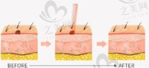 北京解放军总医院301医院整形科骨干医生介绍