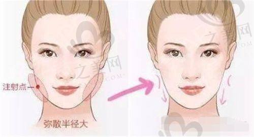 术后成效与满意度