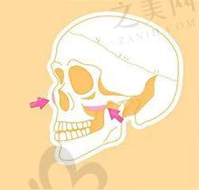 南京金柱翰磨骨优势有哪些