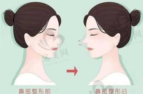 上海医院紧缩针选择:综合考量选良好