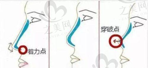 成都华 西整形医院全新价格表