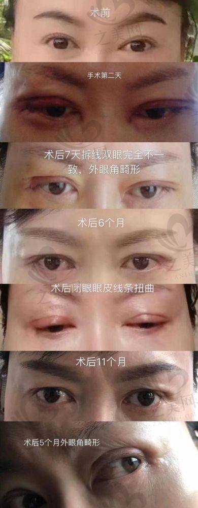 亲身体验之修复情况