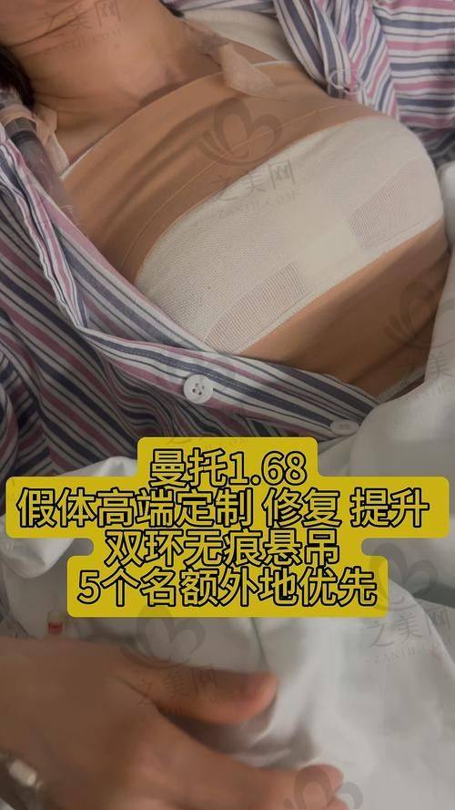 国内排名前五隆胸医院优势