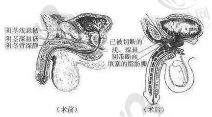 重庆星荣整形：显著的男性生殖整形成效