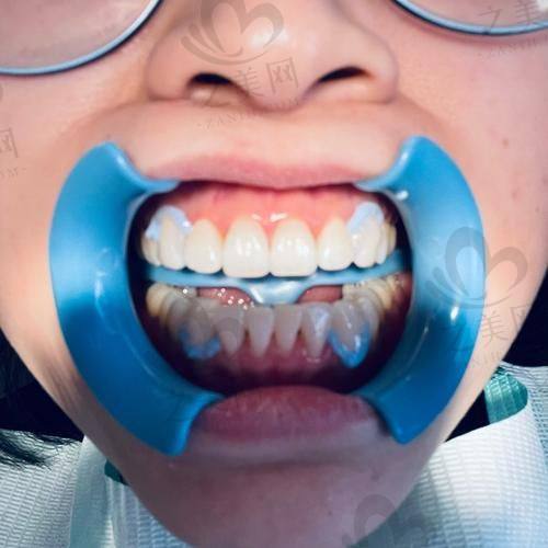服务质量感受