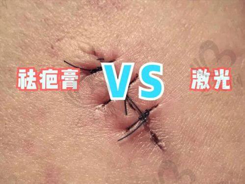 武汉祛疤医院口碑评价依据