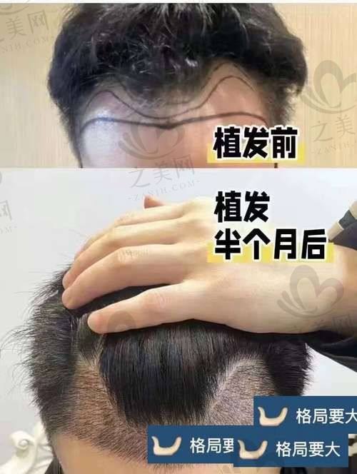 北京首瑞植发院连锁规模情况